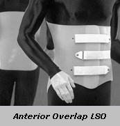 Anterior Overlap LSO