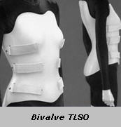 Bivalve TSLO