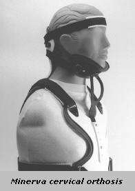 Minerva cervical orthosis