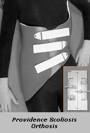 Providence Scoliosis Orthosis