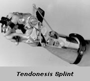 Tendonesis Splint