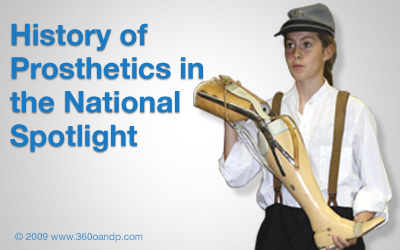 History of Prosthetics in the National Spotlight